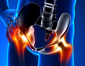 hip replacement lawyers
