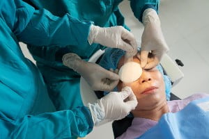 patient getting eye surgery