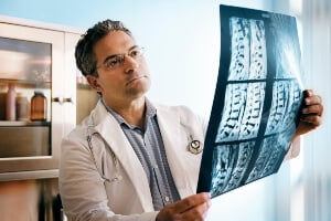 doctor looking at X-ray film